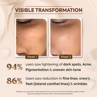Glow Elixir Korean Rice Water Serum with 3% Niacinamide & 1% Alpha Arbutin, 0.5% Ceramide Complex- 30 ML ORUM
