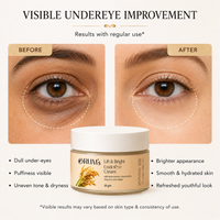 Lift & Bright Under Eye Gel with Rice Water, 2% Niacinamide, 0.2% Retinol, 1% Alpha Arbutin- 20 Gm ORUM