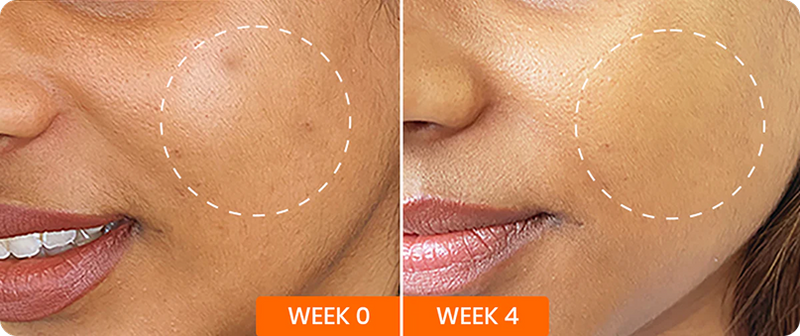 Clinical Result Image